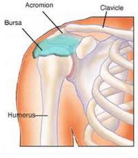 shoulder-bursitis